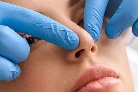 Burun Eti Küçültme Ameliyatı