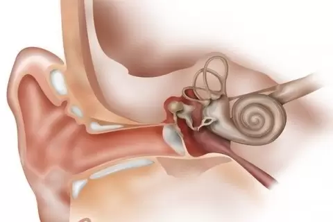 Östaki Tüpü Tıkanıklığı Ameliyatı