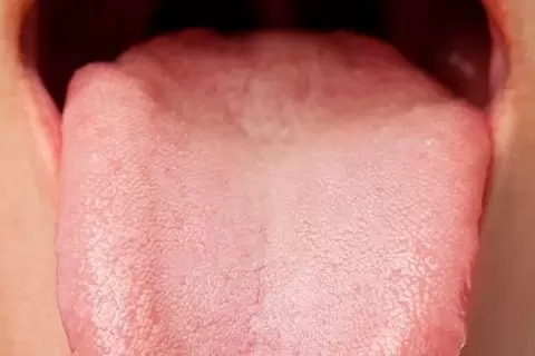 ağız kokusu tedavisinde derin dil kökü temizliği